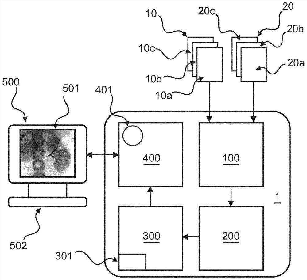 Kidney denervation ablation monitoring using perfusion angiography