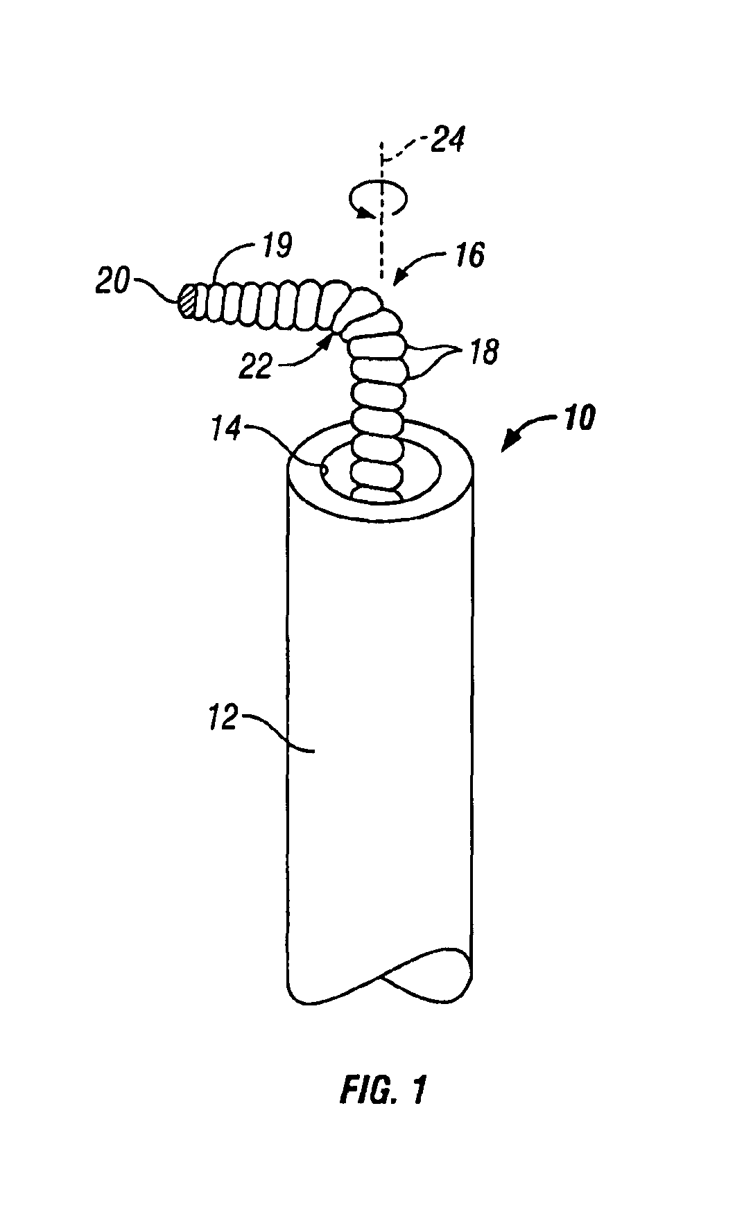 Device for sensing parameters of a hollow body organ
