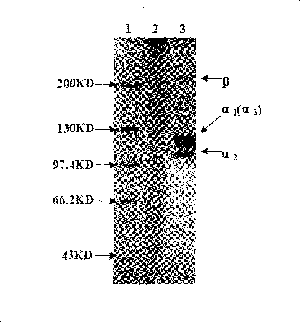 Method for preparing undenatured collagen from fish scale of fresh water fish