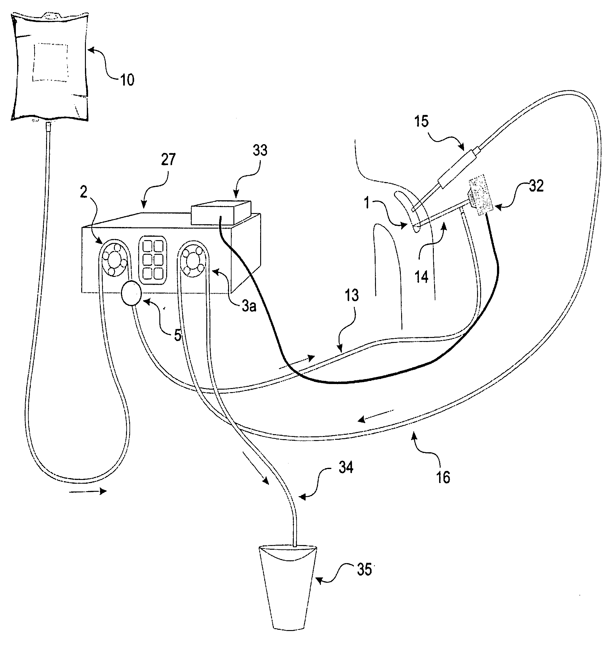 Method and device for irrigation of body cavities
