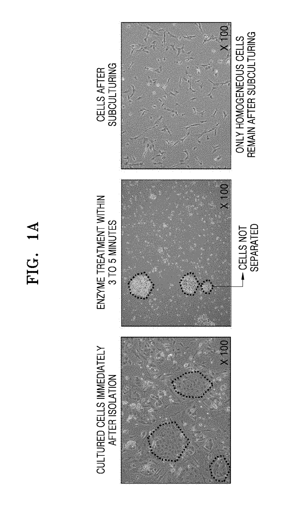 Improved postnatal adherent cells and preparation method therefor