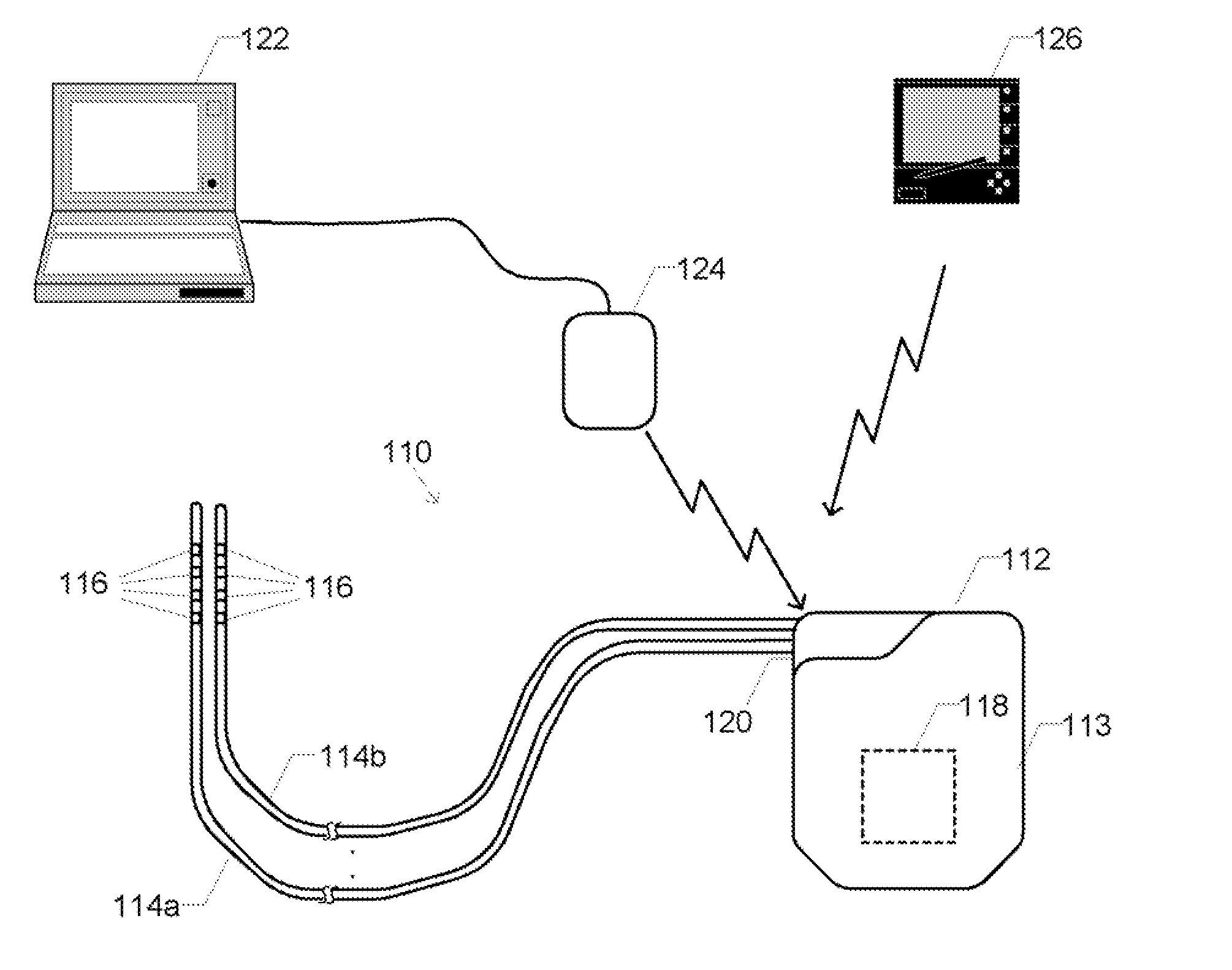 Methods, devices and systems for programming neurostimulation