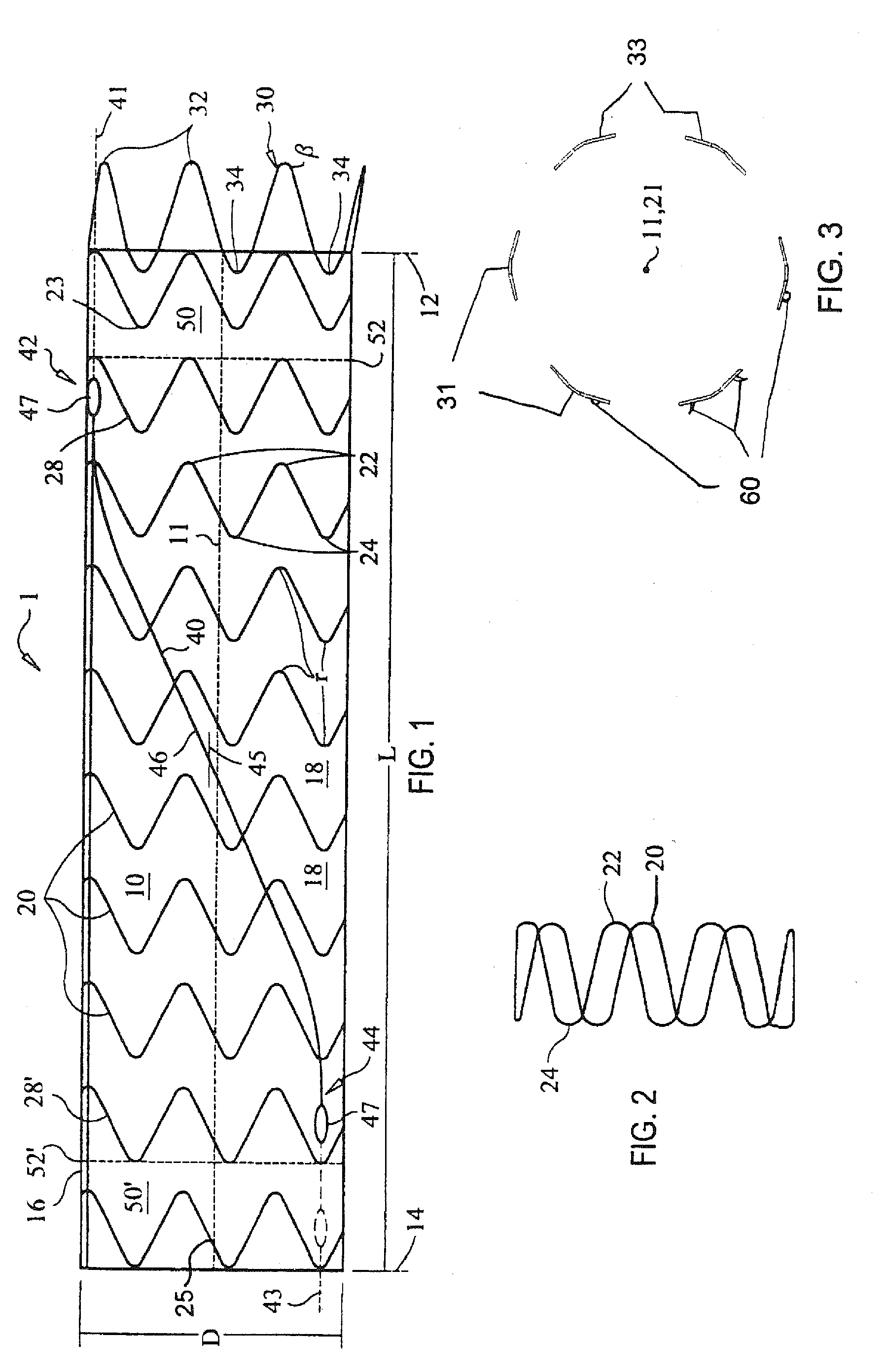 Sheath Capture Device for Stent Graft Delivery System and Method for Operating Same