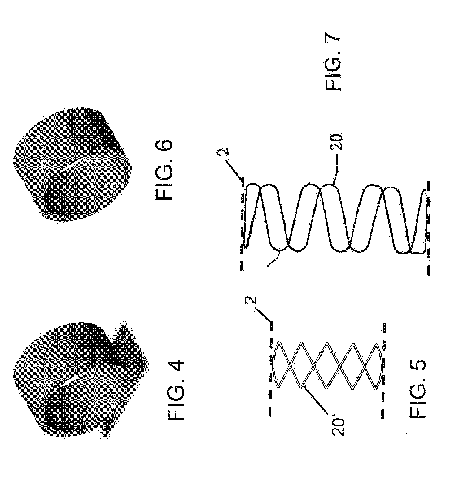 Sheath Capture Device for Stent Graft Delivery System and Method for Operating Same