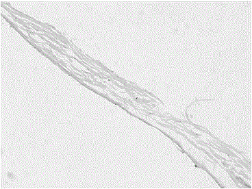 A kind of anti-adhesion biofilm and preparation method thereof