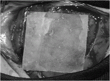 A kind of anti-adhesion biofilm and preparation method thereof