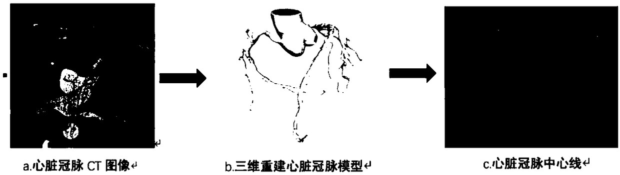 Automatic segmentation and naming method of cardiac coronary artery vessels