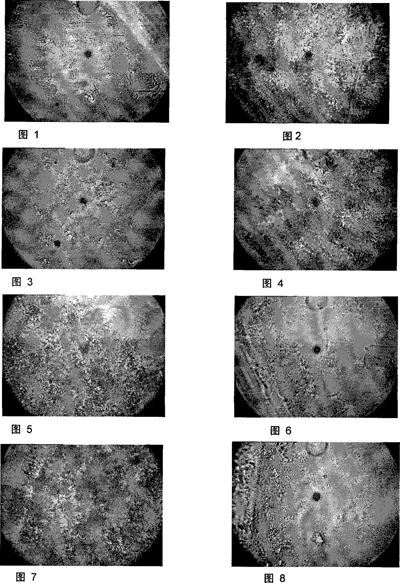 Fast-culturing  susceptibility and micro-detection method for mycobacteria and device thereof