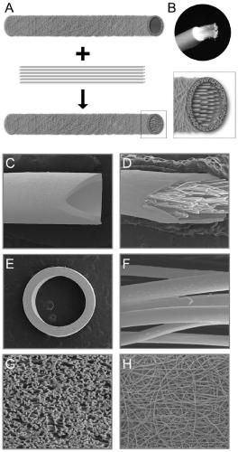Bionic degradable artificial nerve conduit for regulating and controlling immune microenvironment and guiding regeneration by utilizing topological structure, and preparation method of bionic degradable artificial nerve conduit