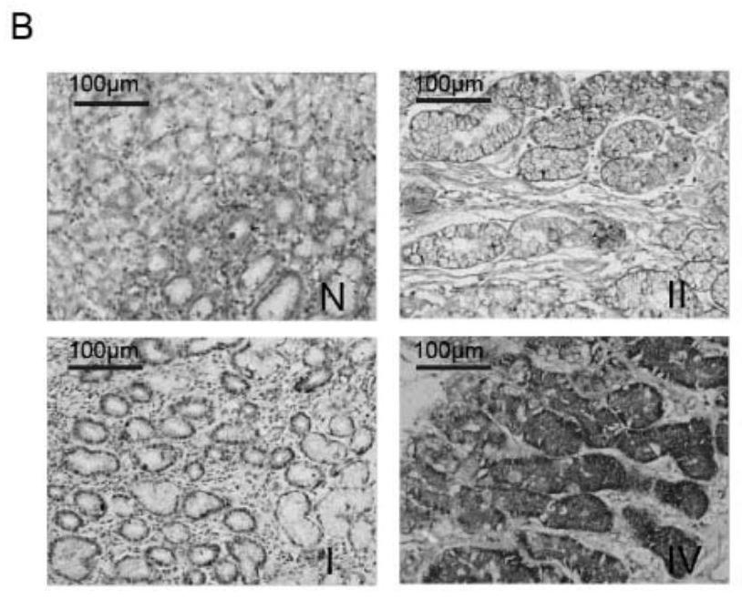 Application of macc1-as1 probe in preparation of diagnostic reagents for predicting clinical prognosis of gastric cancer