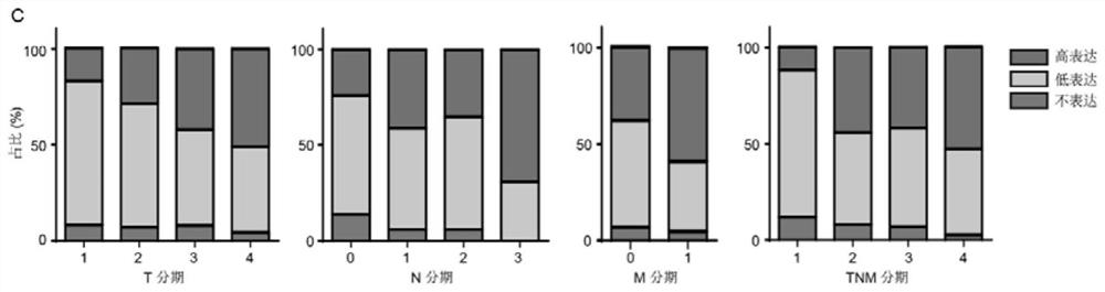 Application of macc1-as1 probe in preparation of diagnostic reagents for predicting clinical prognosis of gastric cancer