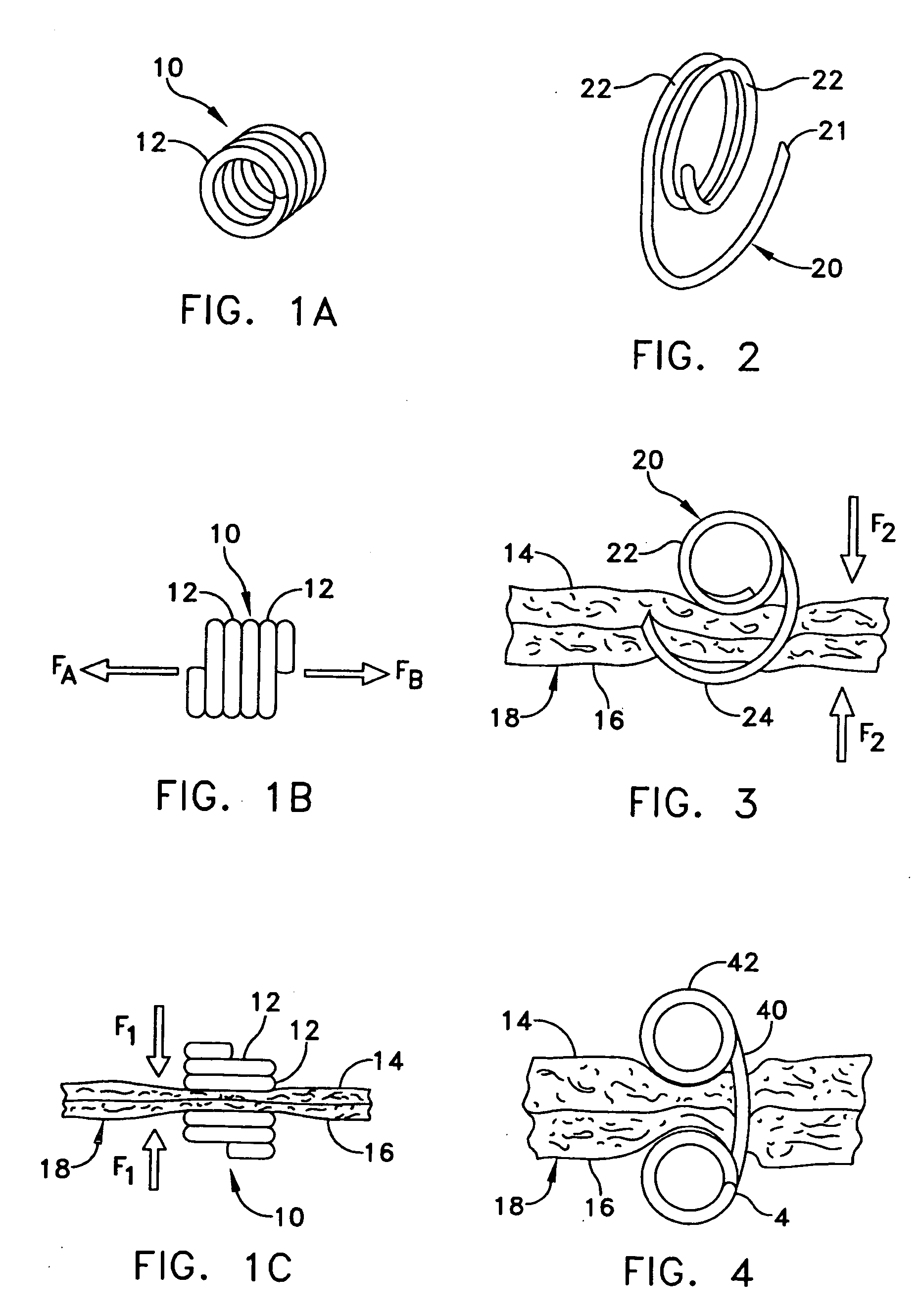 Vascular bypass grafting instrument and method