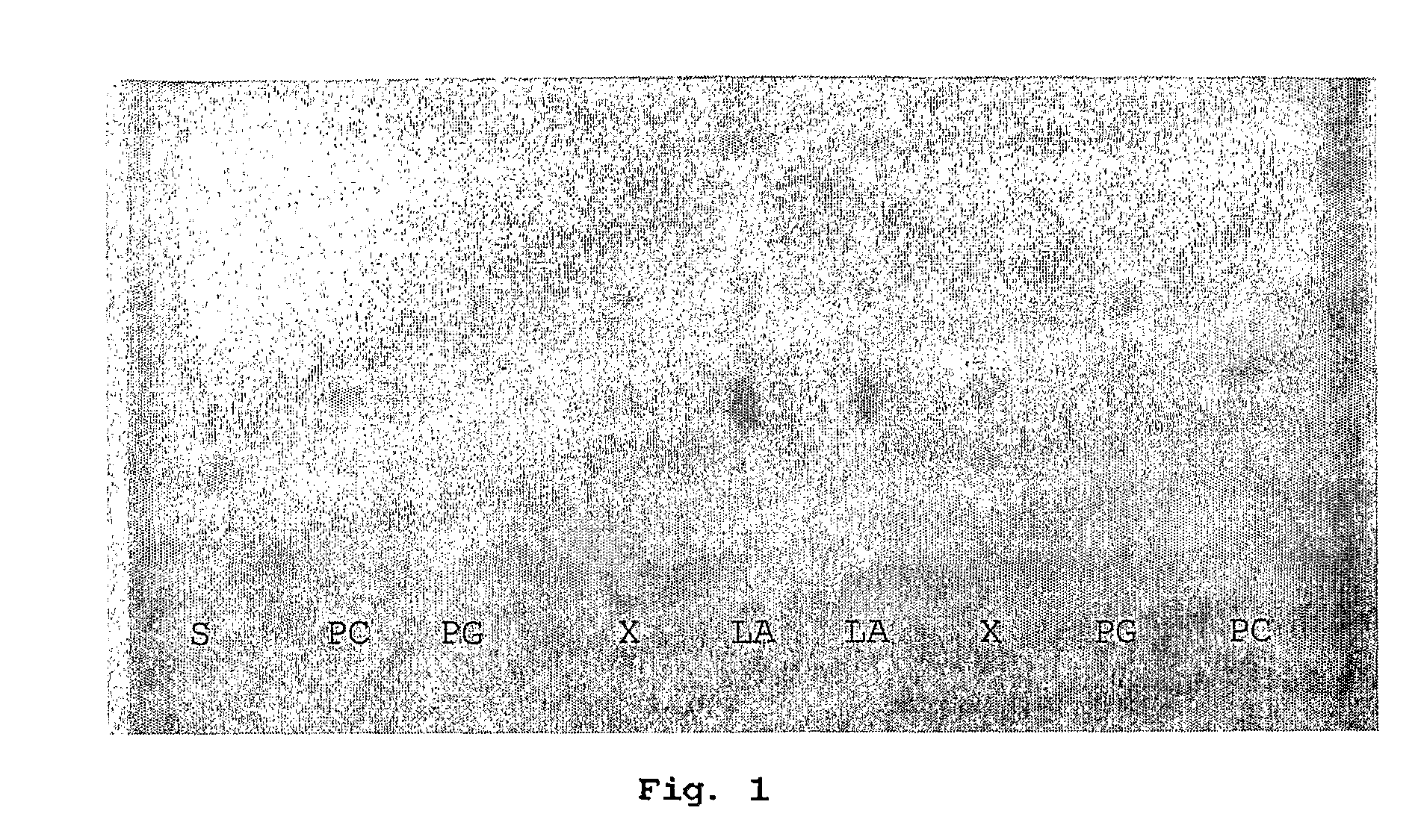 Method for the determination of phospholipids in amniotic fluid samples