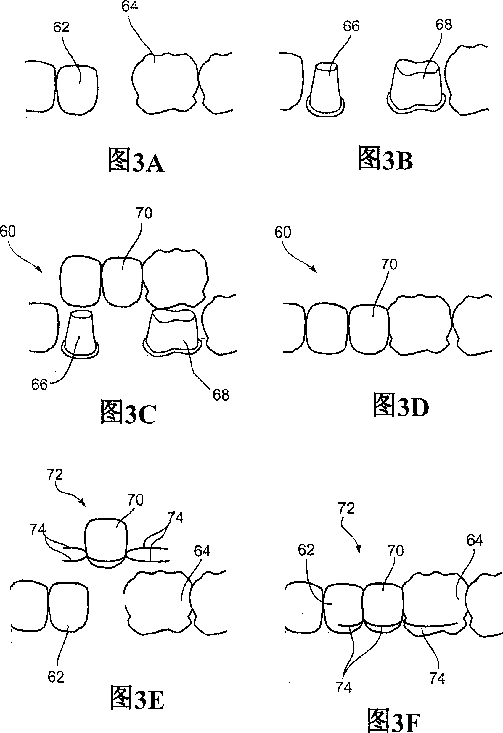Oral devices and methods for controlled drug delivery