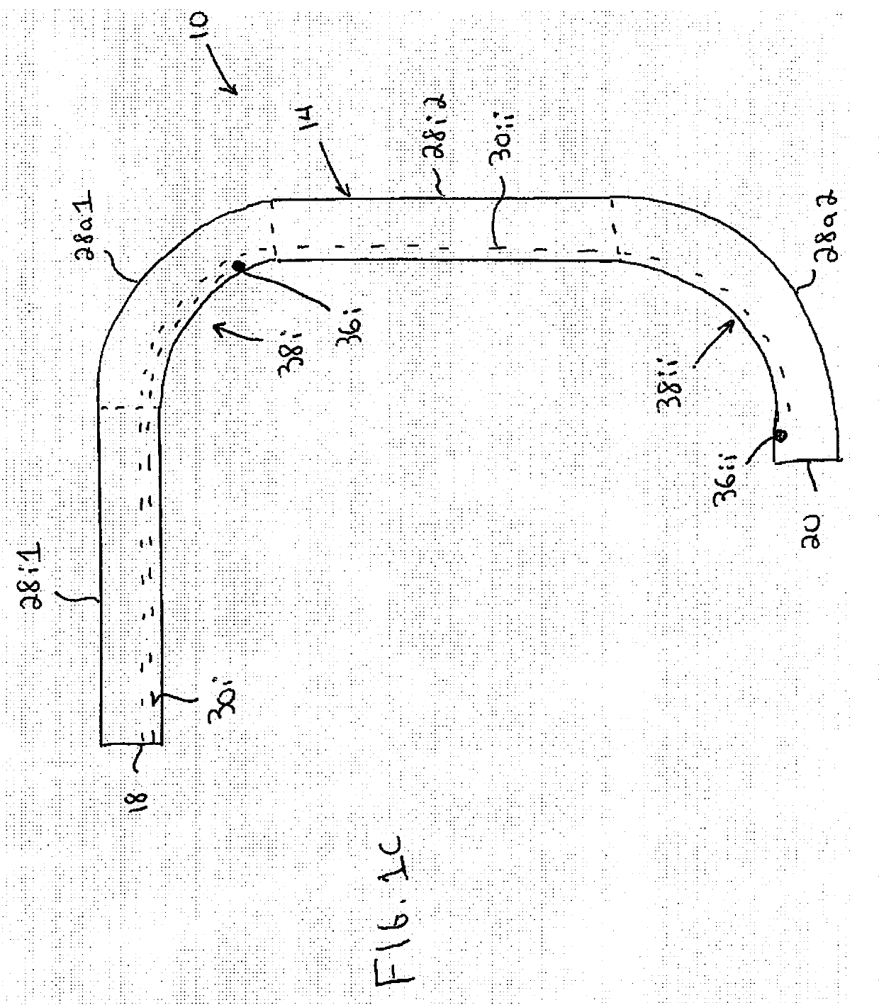 Trans-radial access endovascular catheters and methods of use