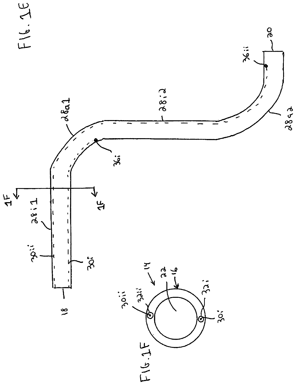 Trans-radial access endovascular catheters and methods of use