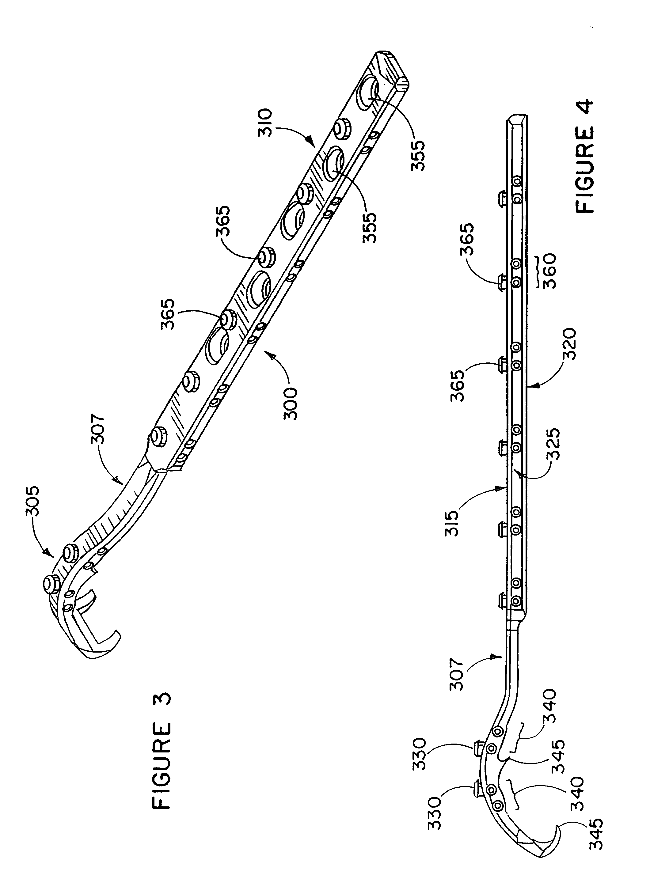 Apparatus and method for repairing the femur