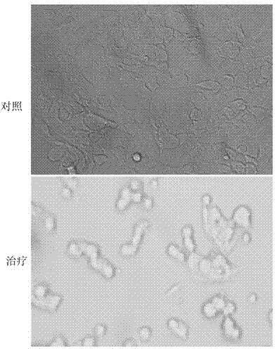 High tropism bladder cancer targeting tumor-killing adenovirus