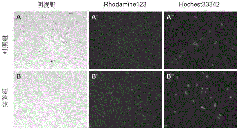 A culture method for improving oxidative metabolism of chicken skeletal muscle cells