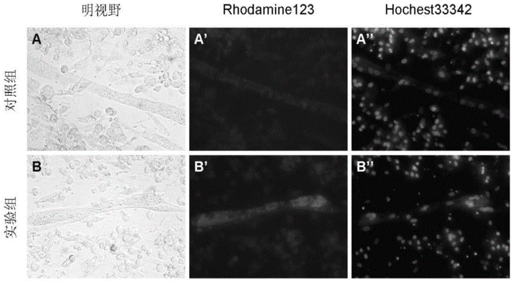 A culture method for improving oxidative metabolism of chicken skeletal muscle cells