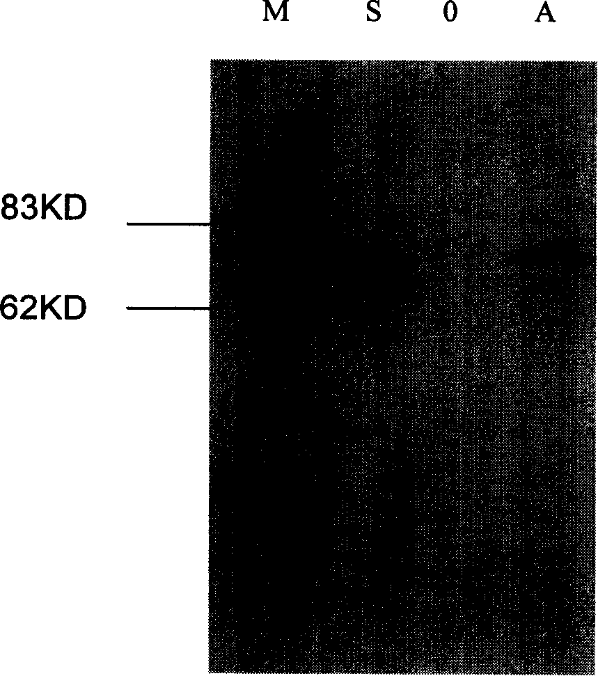 Method for producing transgene protein medicine of mammary gland expression using gland virus as carrier mammary