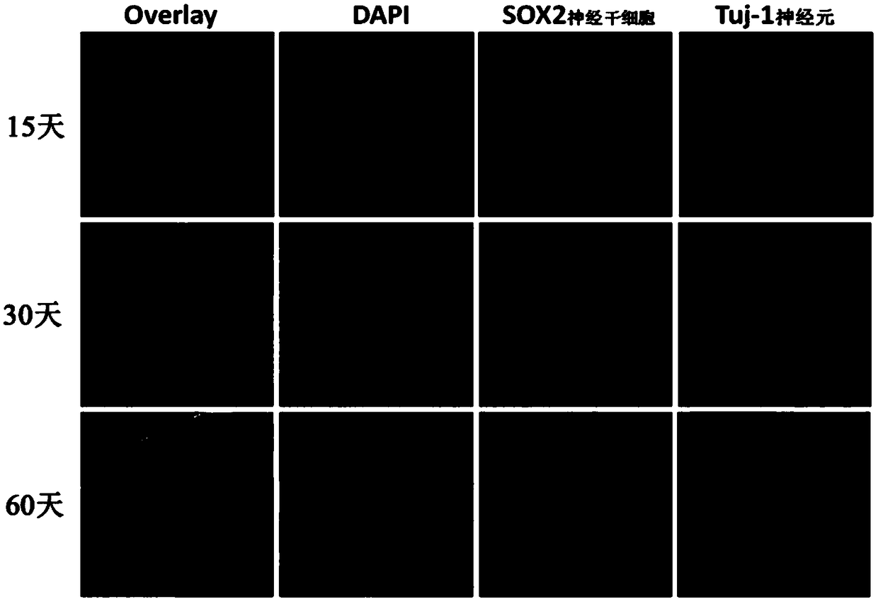 Application of humanized brain-like organ to brain injury dyskinesia disease