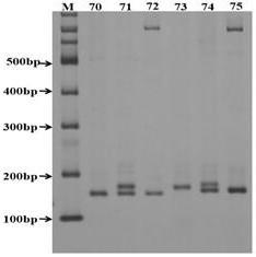 High-quality DNA extraction method of idesia polycarpa