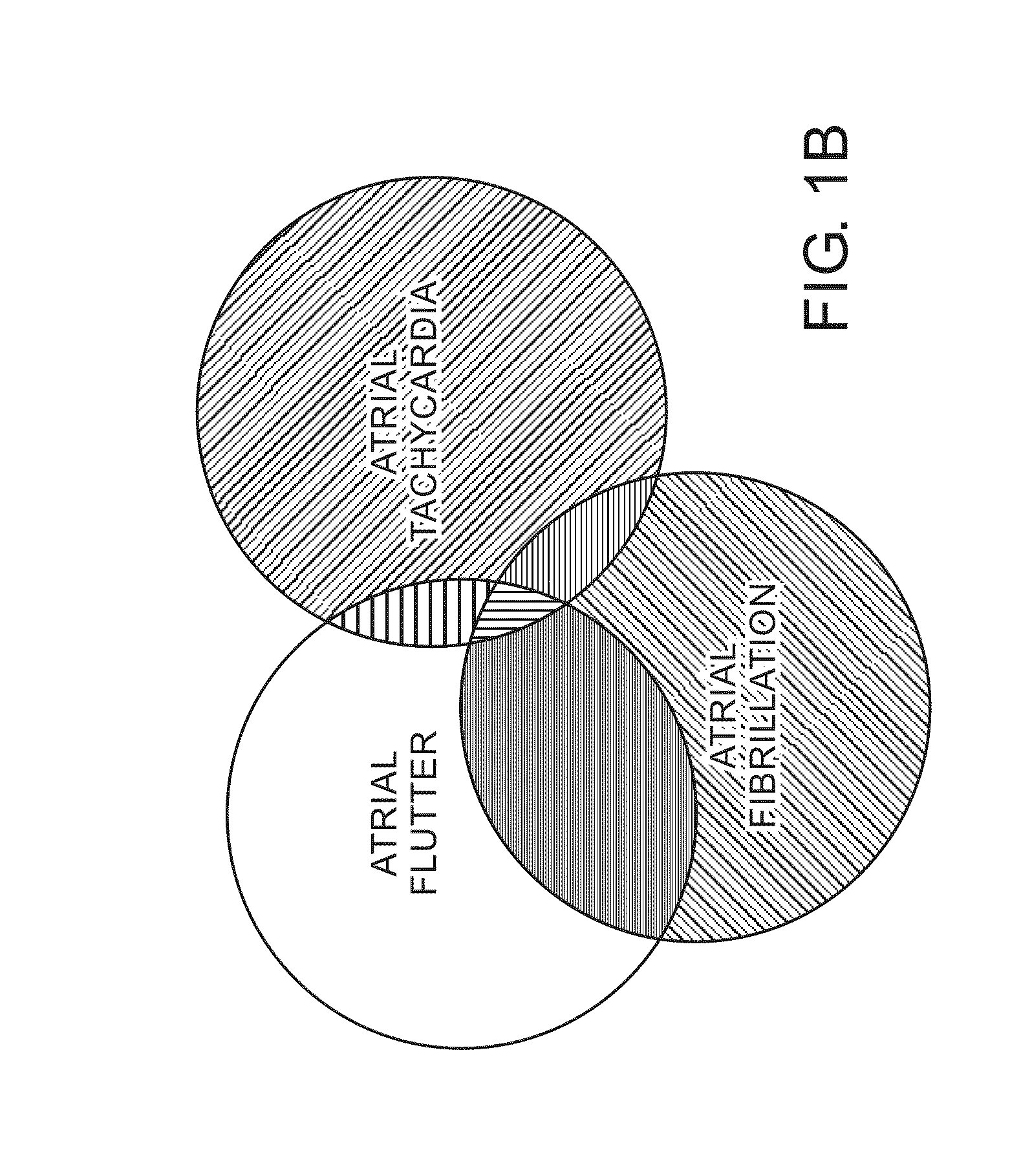 Methods and implantable devices for treating supraventricular arrhythmias