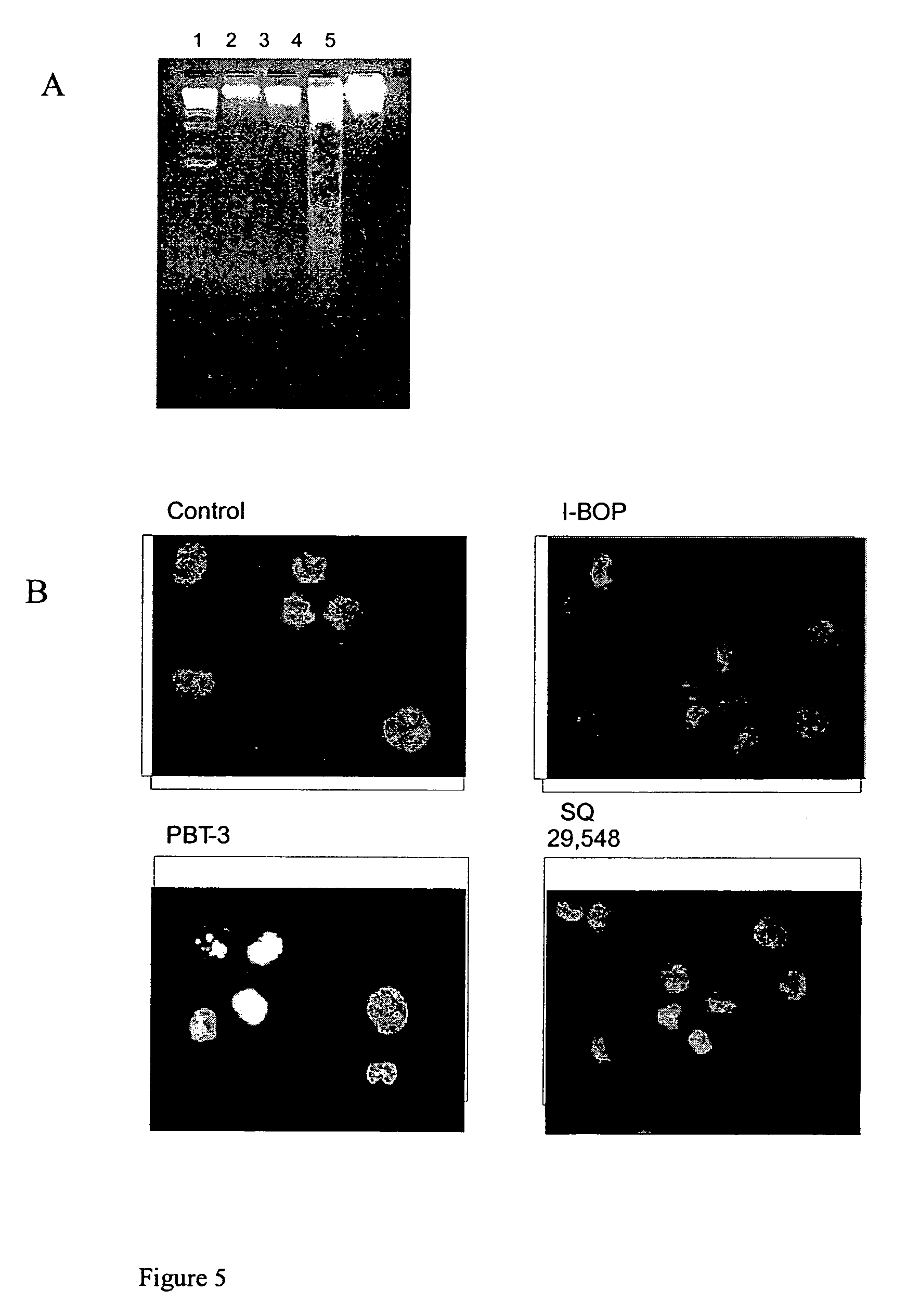 Compositions comprising hepoxilin analogs and their use in the treatment of cancer