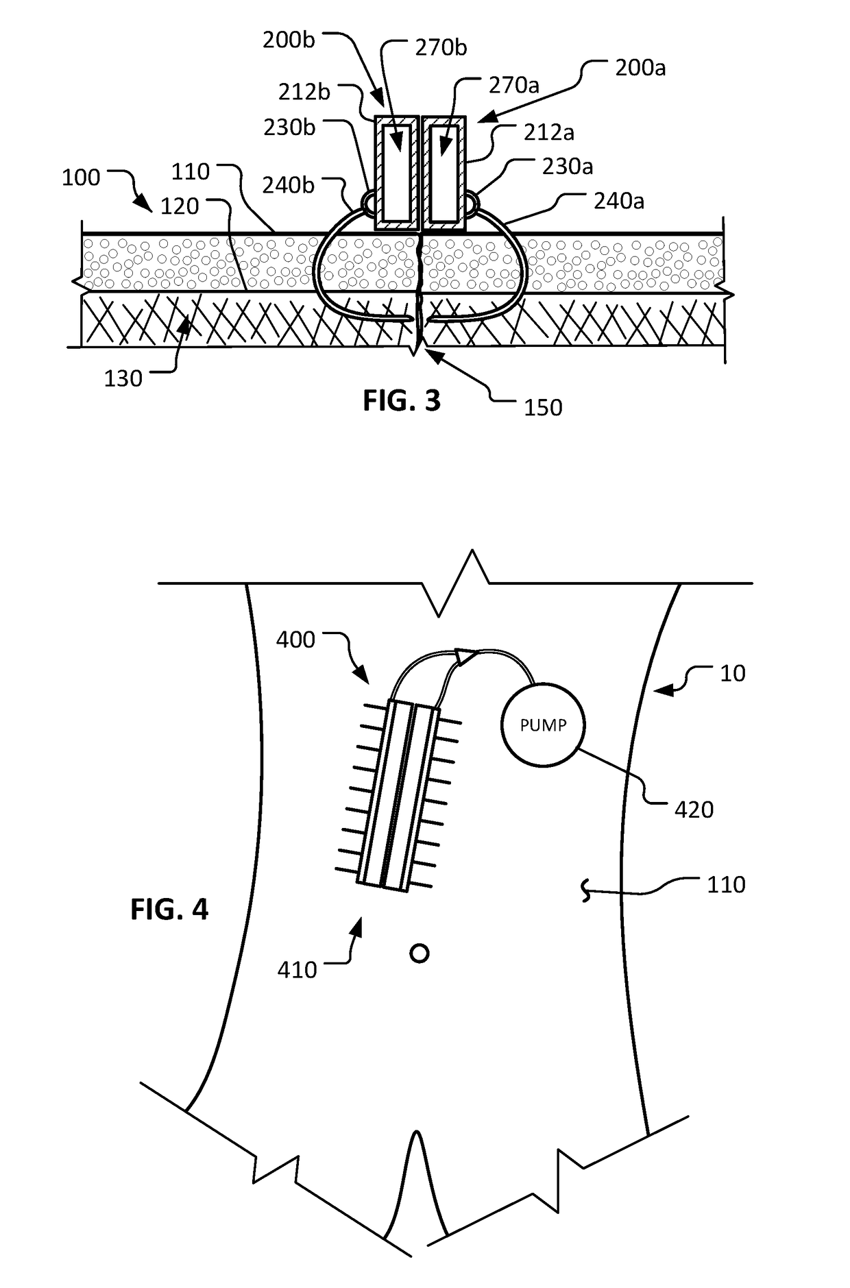 Magnetic wound closure systems