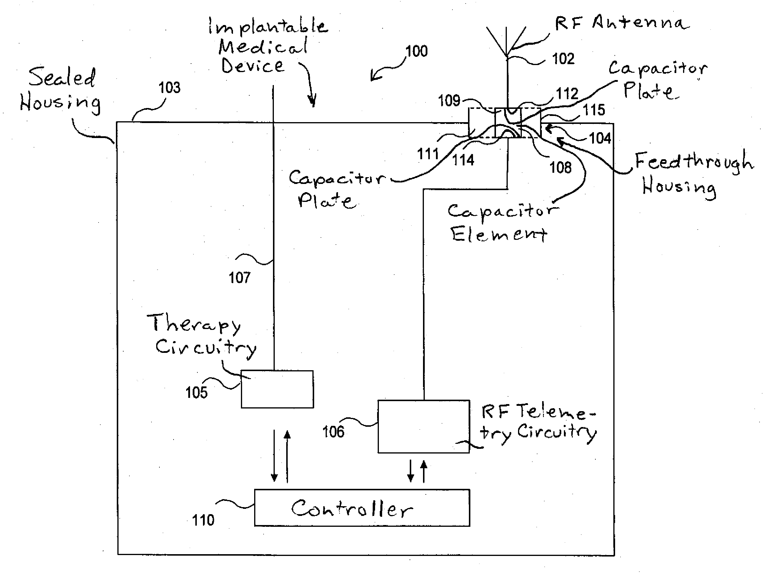 Implantable Medical Device with a Voltage Protection Circuit