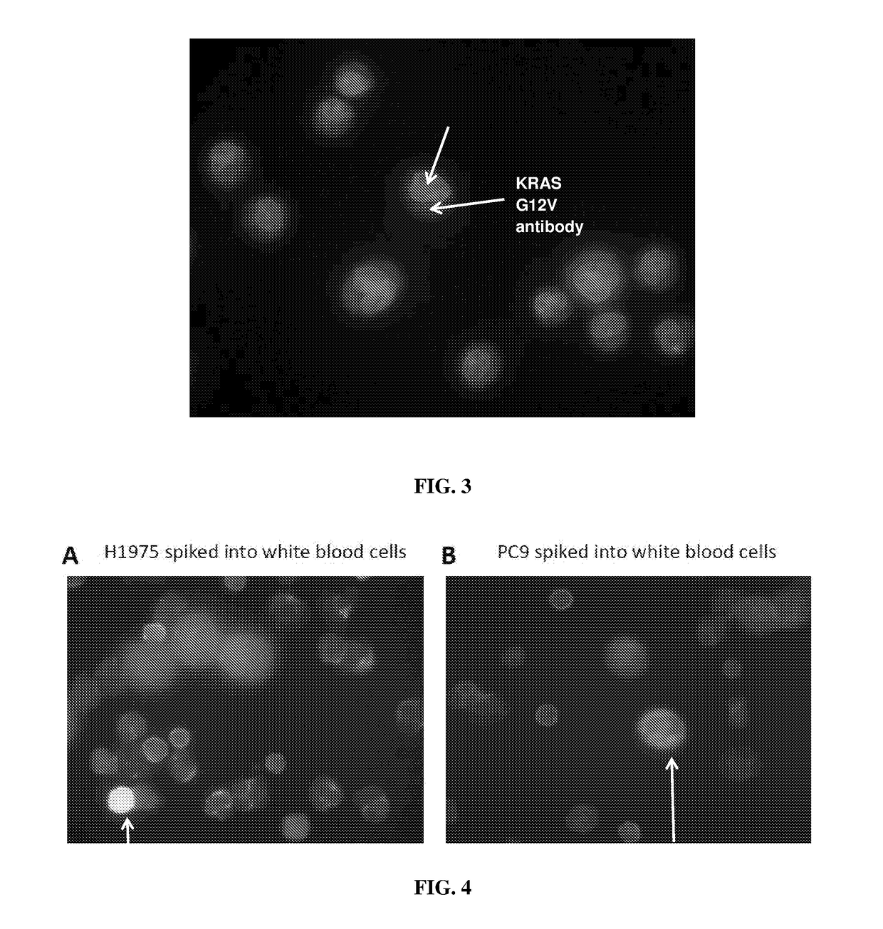 Method for detecting circulating tumor cells and uses thereof