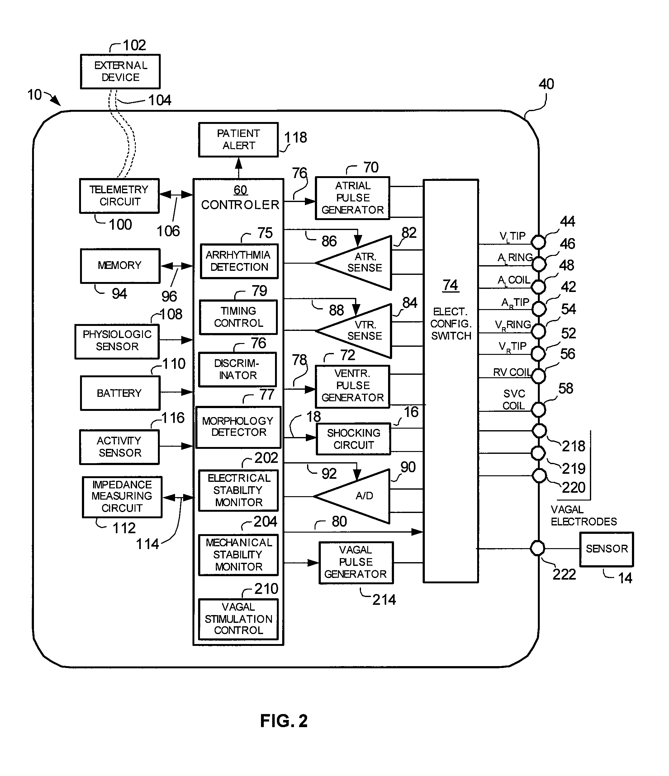 Systems and methods for detecting alternans in intrinsic rhythms to monitor myocardial stability