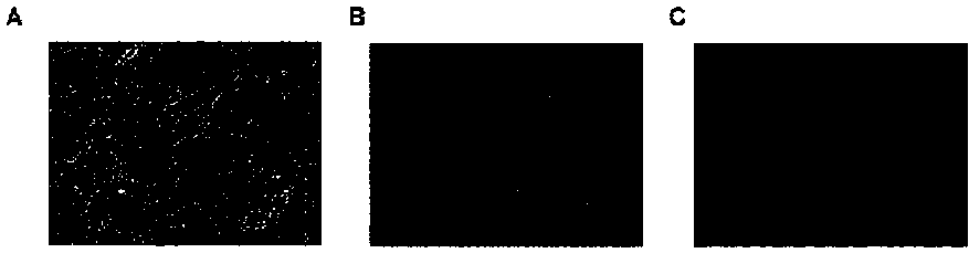 Method for inducing iPSCs or ESCs to be differentiated into brown fat cells