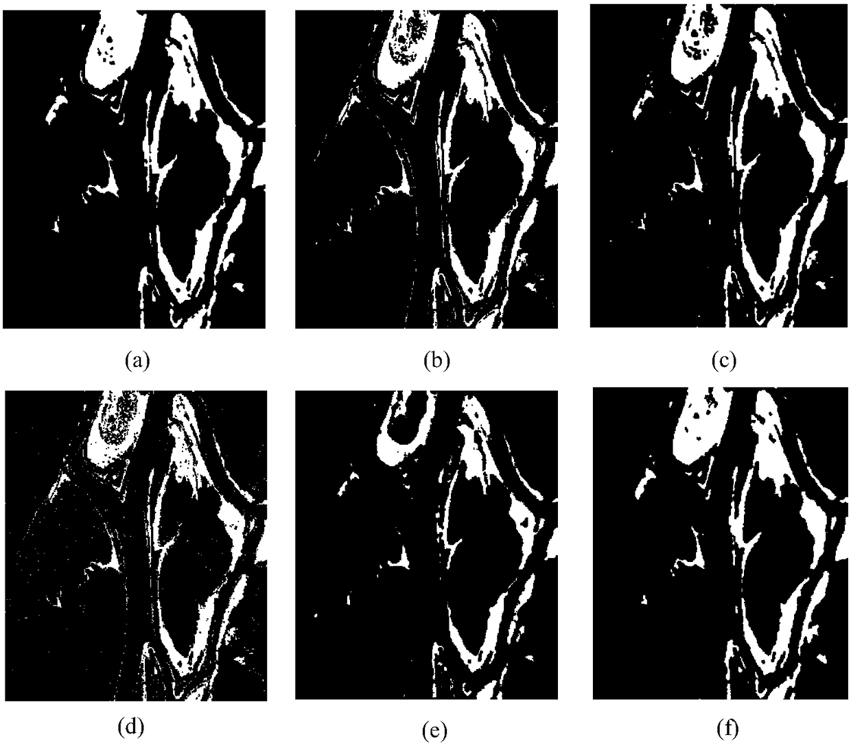 Sar image change detection method based on saliency fusion