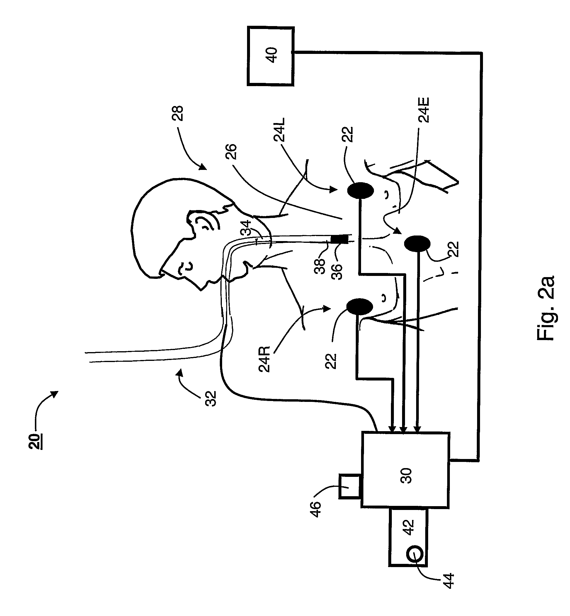 Method device and system for monitoring lung ventilation