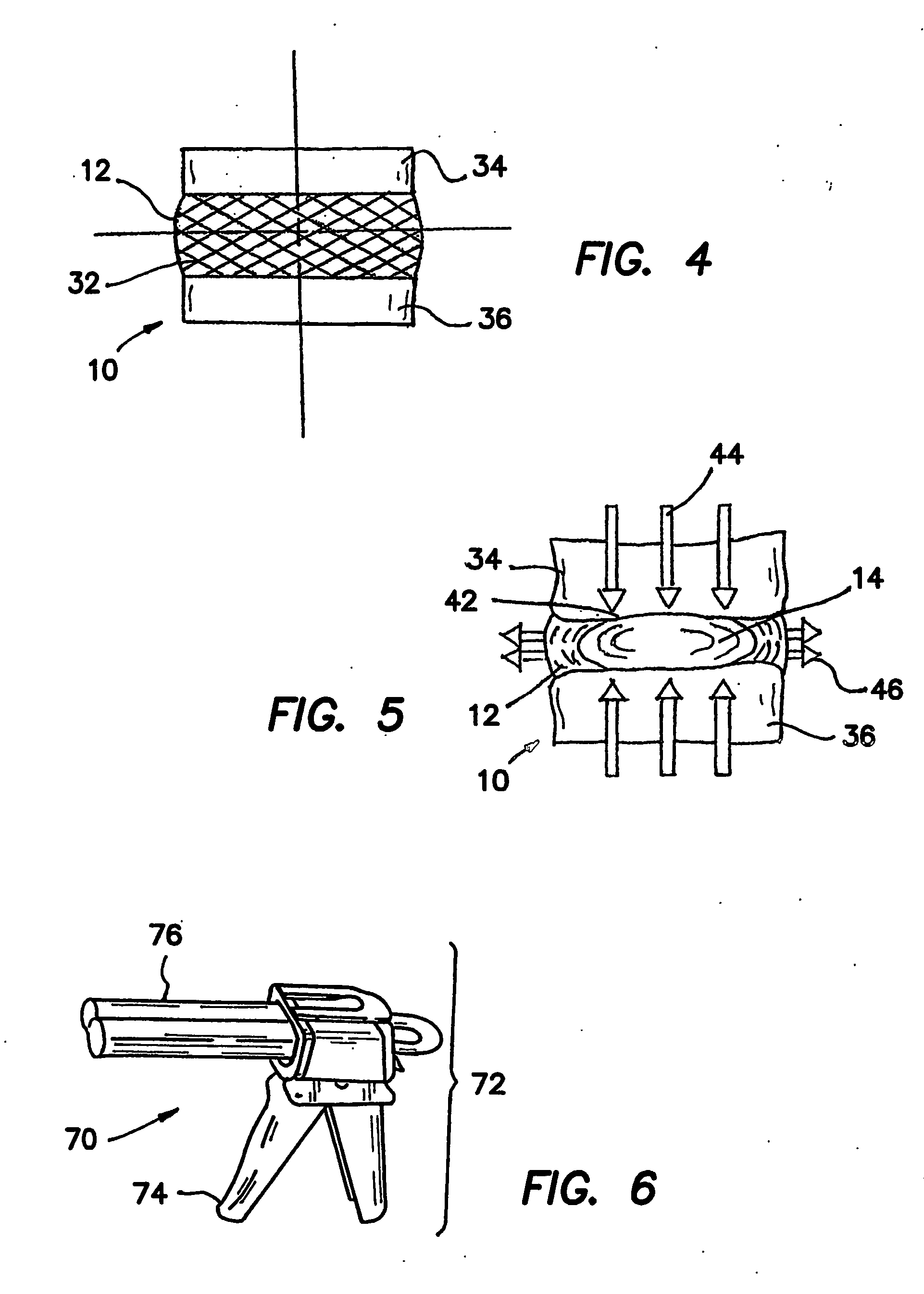 Artificial nucleus pulposus and method of injecting same