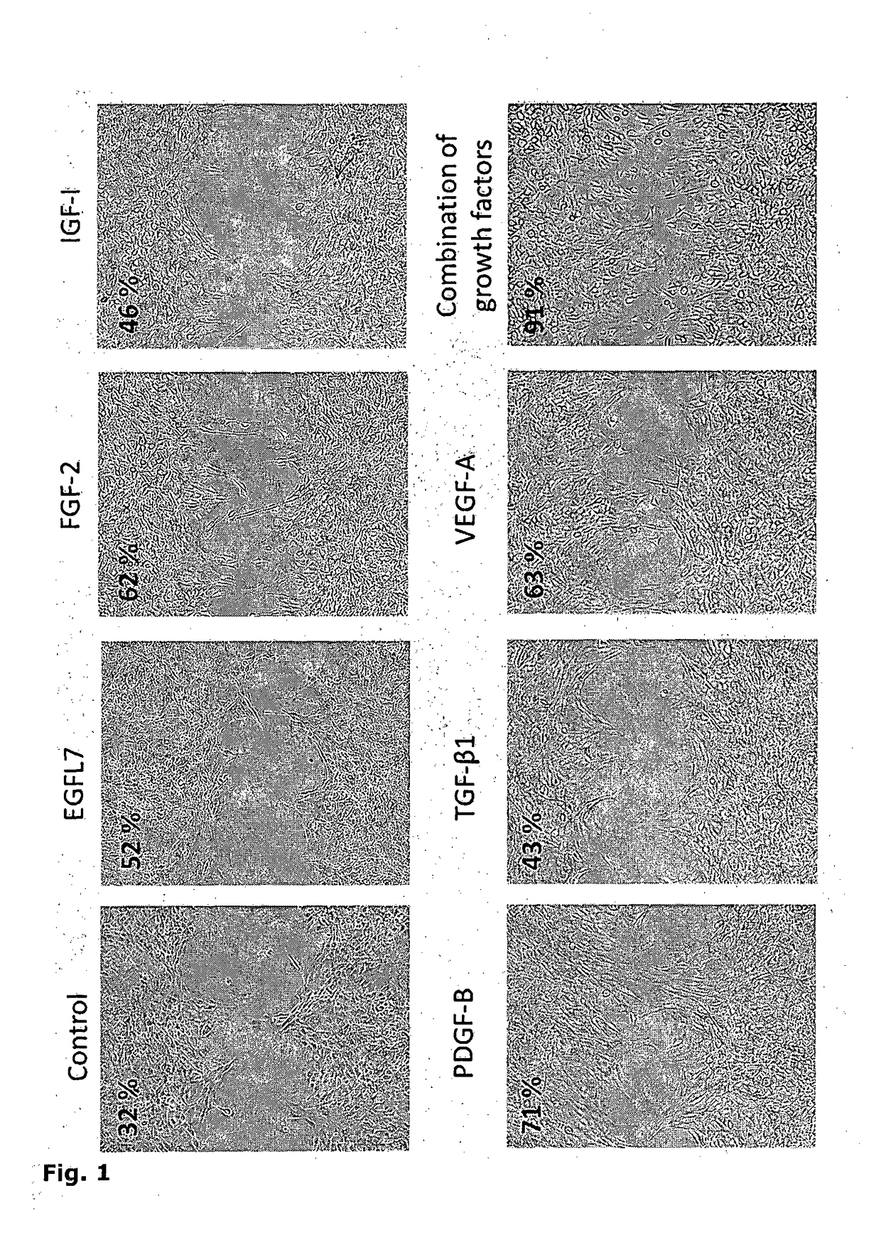 Cell-Based Device For Local Treatment With Therapeutic Protein