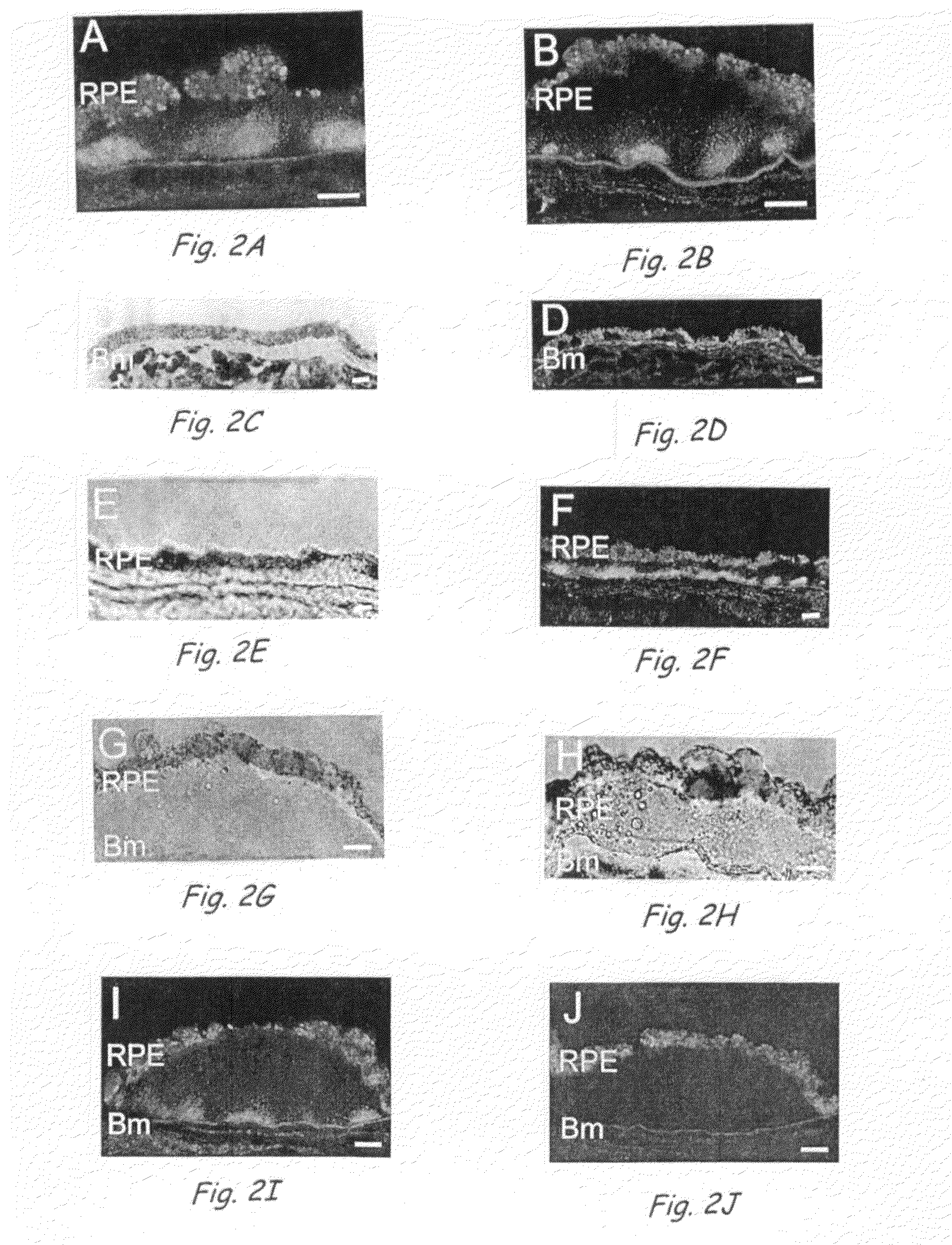 Compositions and Methods for Inhibiting Drusen Formation and for Diagnosing or Treating Drusen-Related Disorders