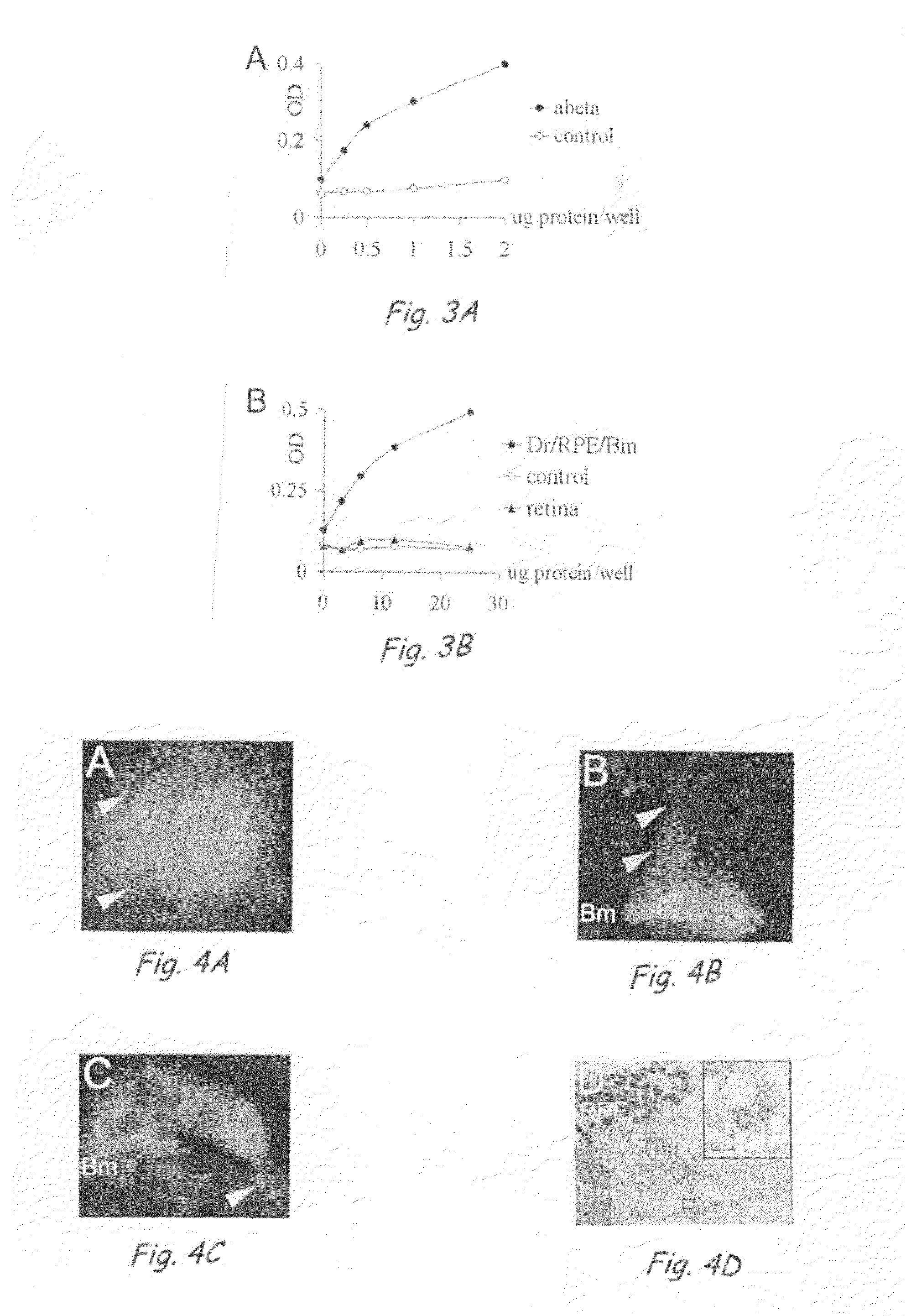 Compositions and Methods for Inhibiting Drusen Formation and for Diagnosing or Treating Drusen-Related Disorders