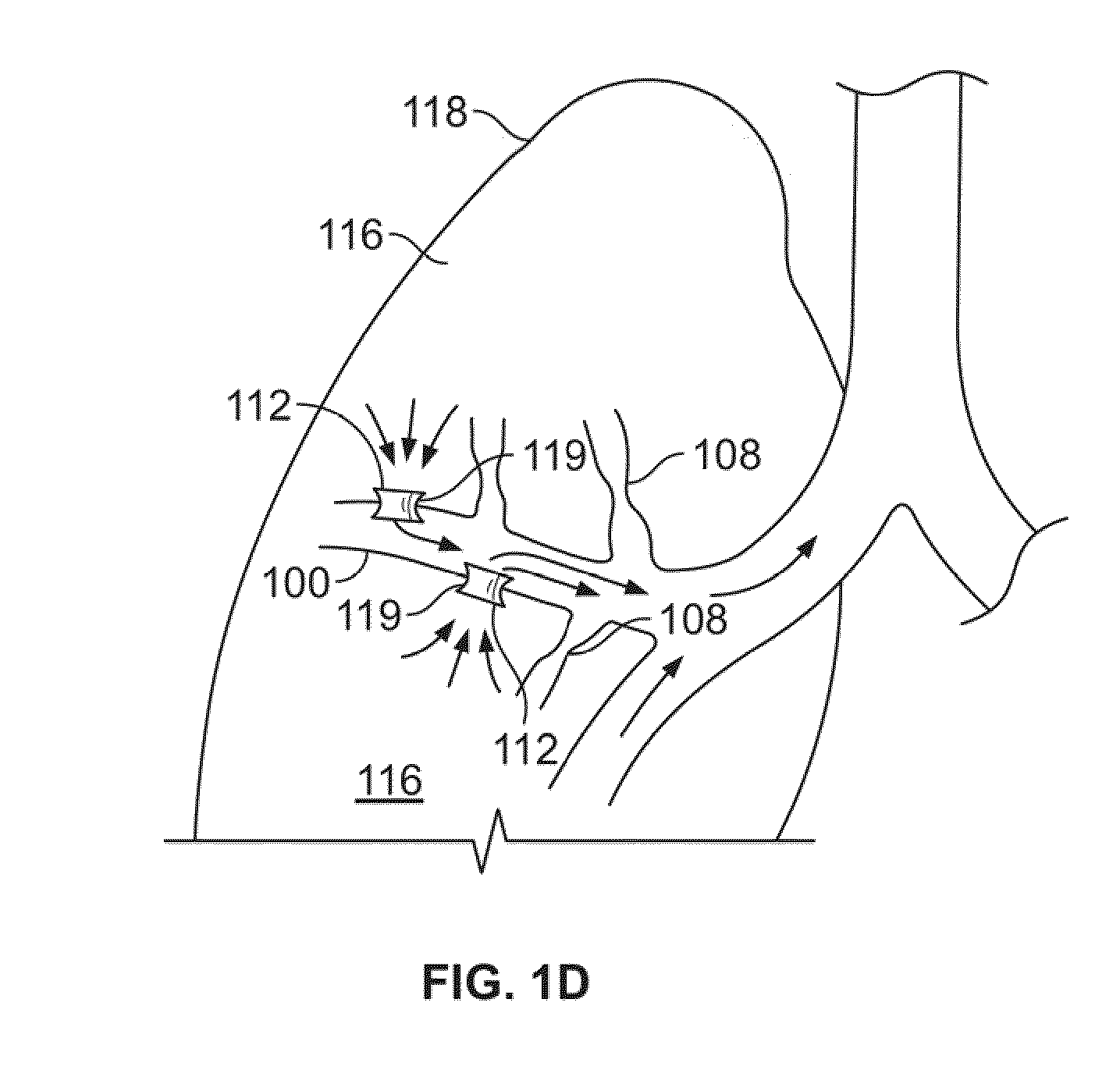 Devices for creating passages and sensing for blood vessels