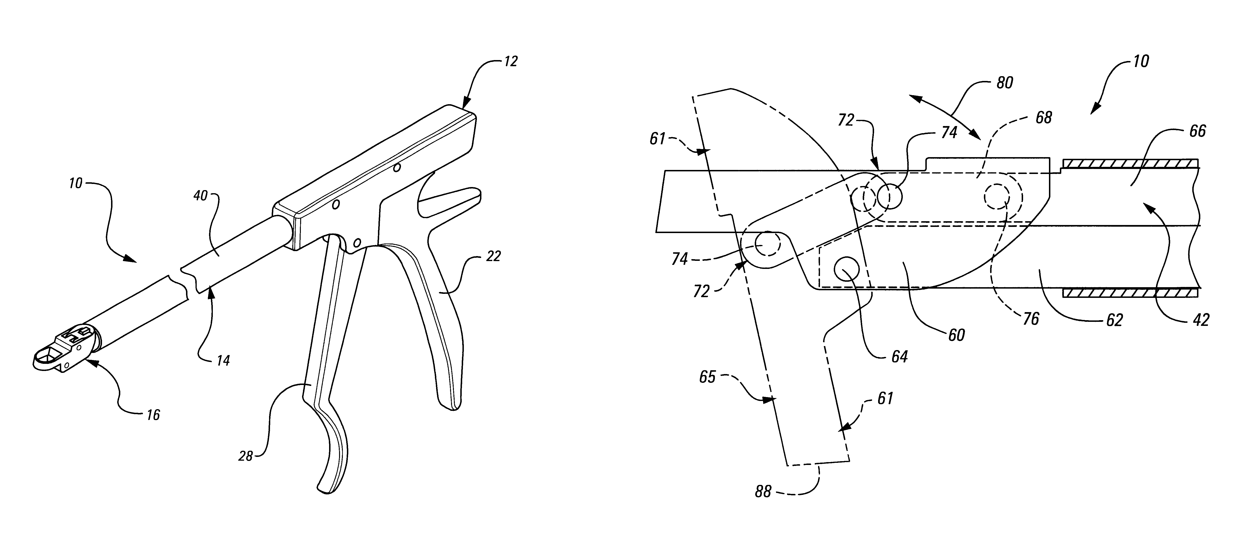 Circumferential resecting reamer tool