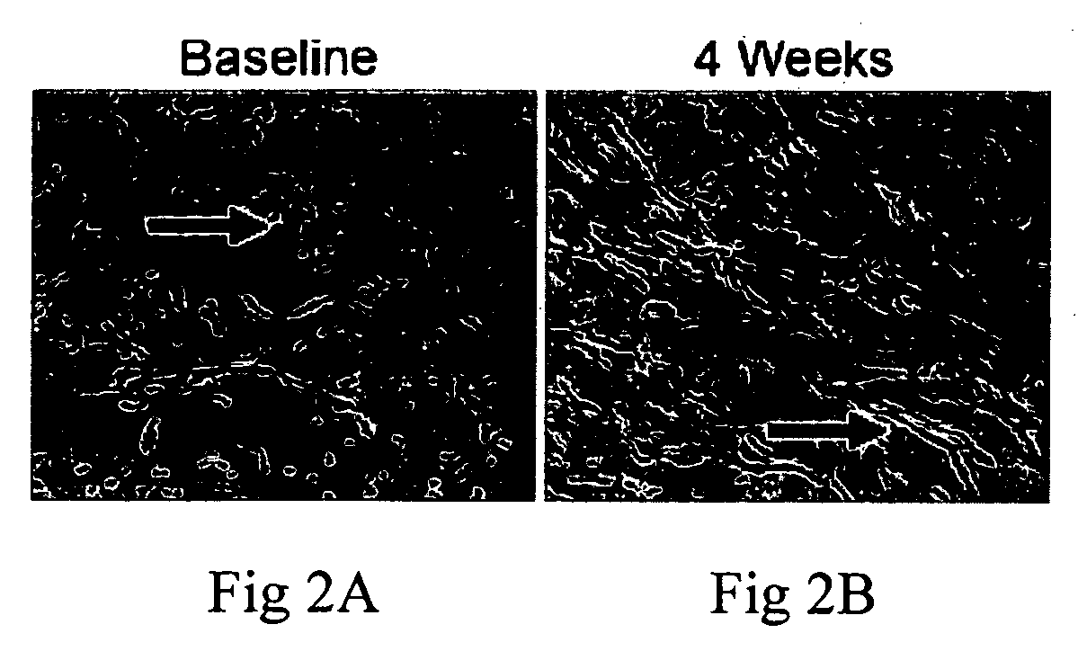 Anti-aging treatment using copper and zinc compositions
