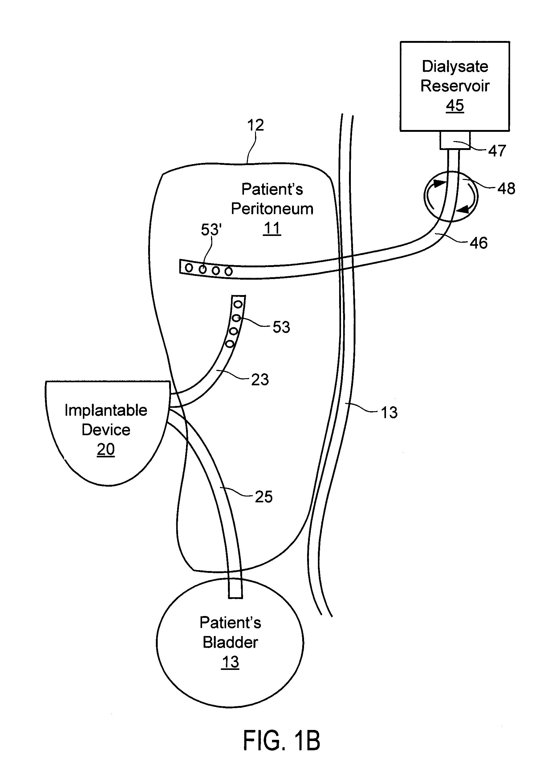 Systems and methods for treating chronic liver failure based on peritoneal dialysis