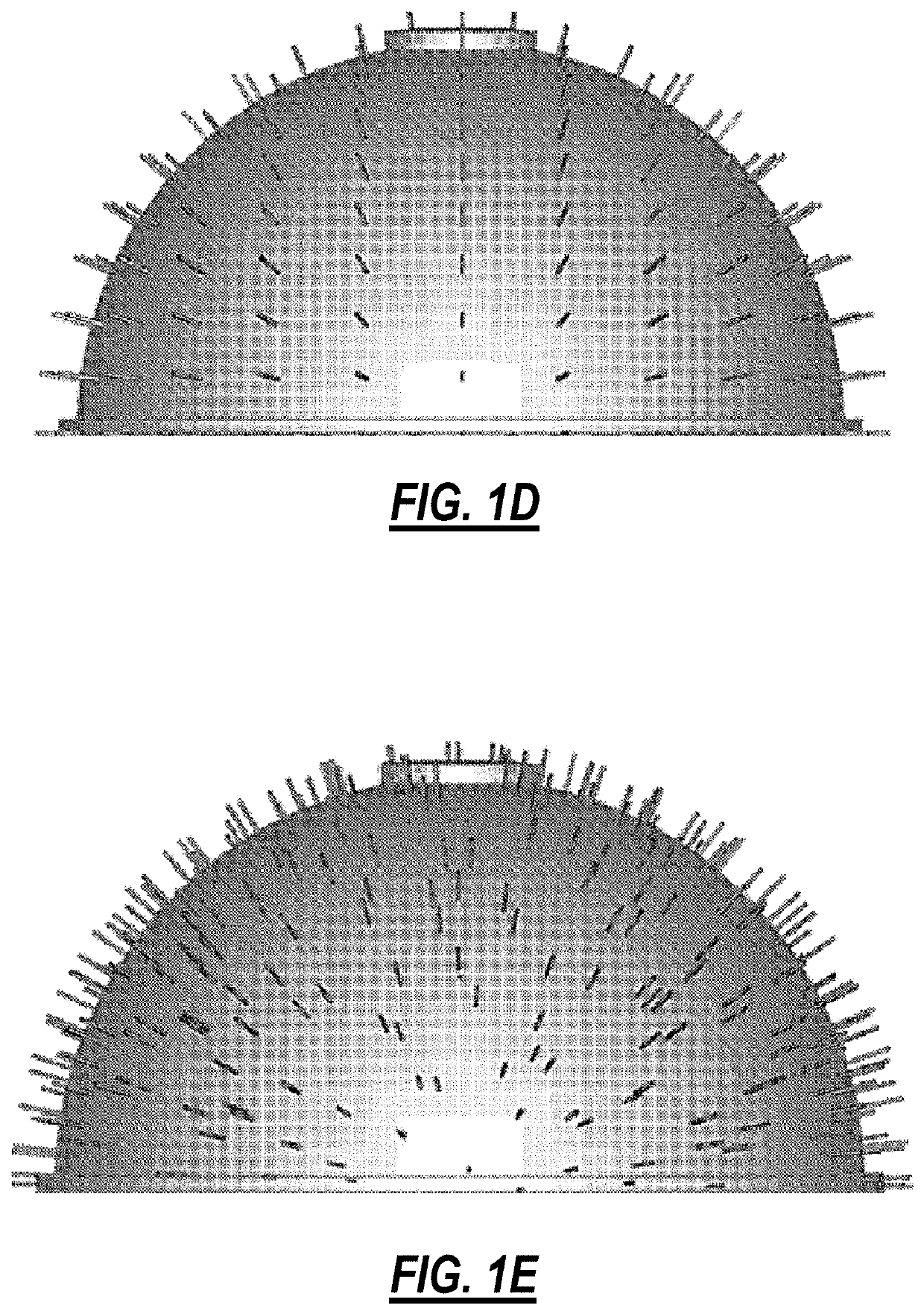 Surgical implant devices incorporating porous surfaces