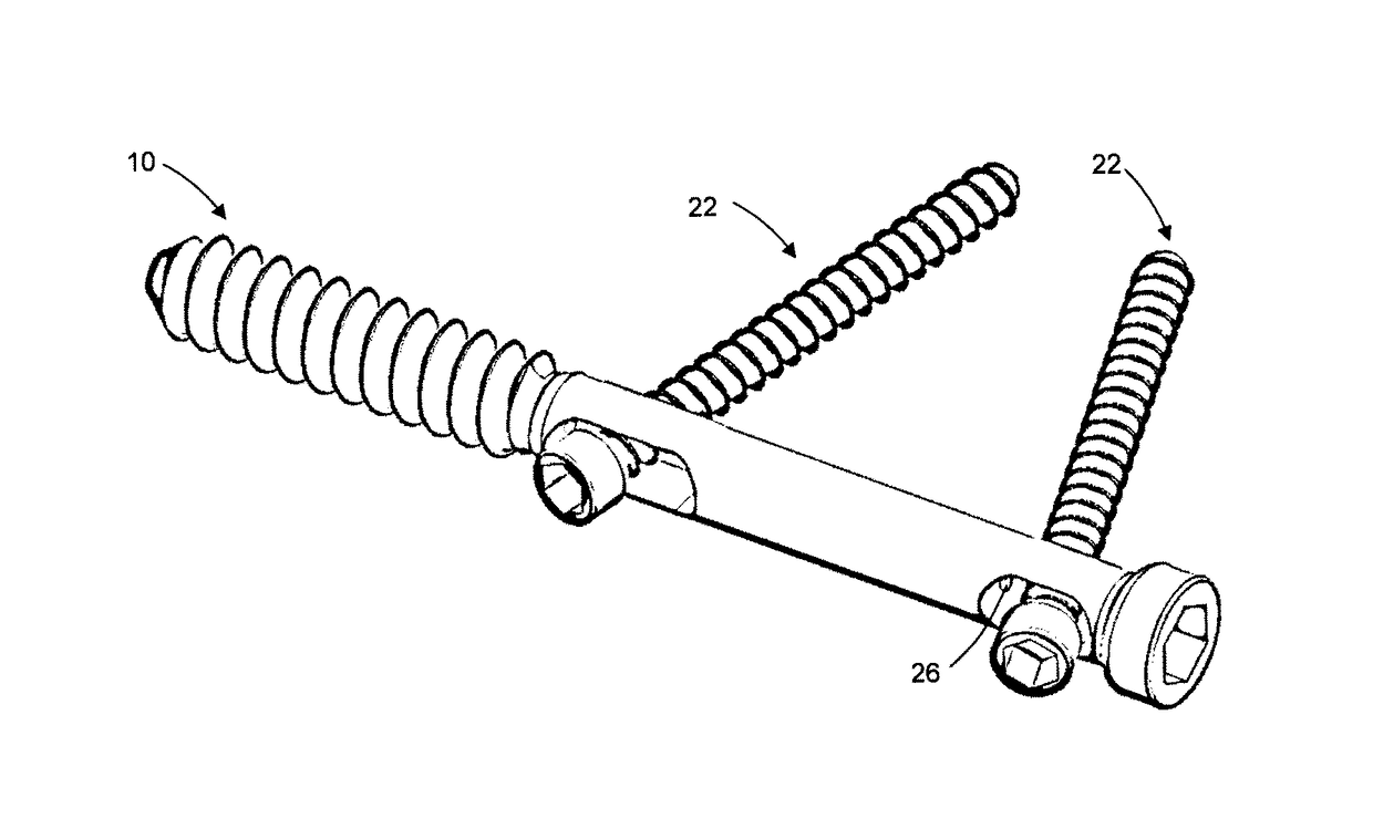 Bone screw, and bone fixation system and method