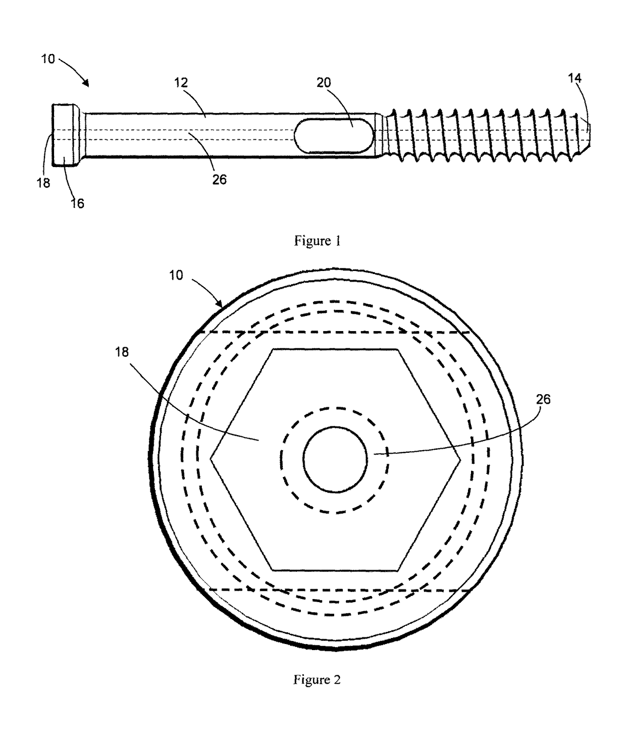 Bone screw, and bone fixation system and method