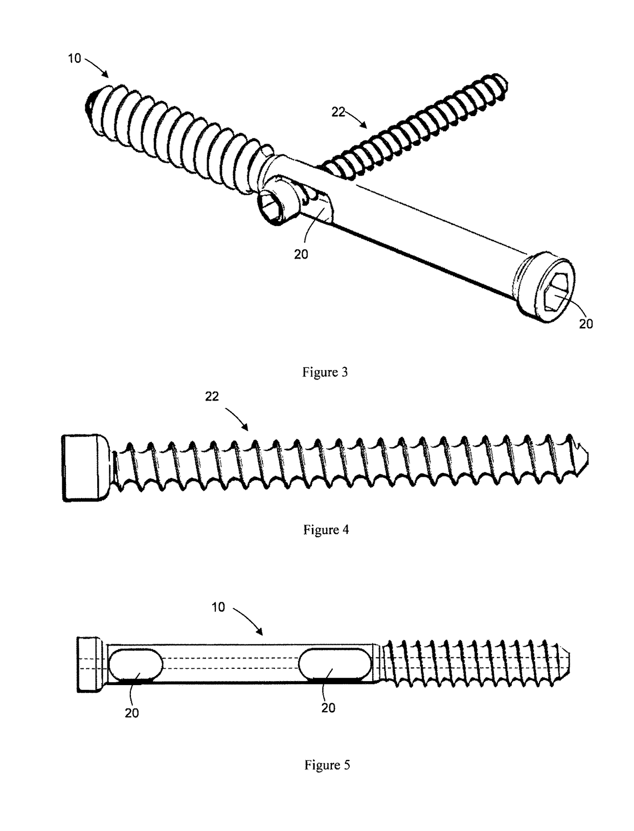 Bone screw, and bone fixation system and method