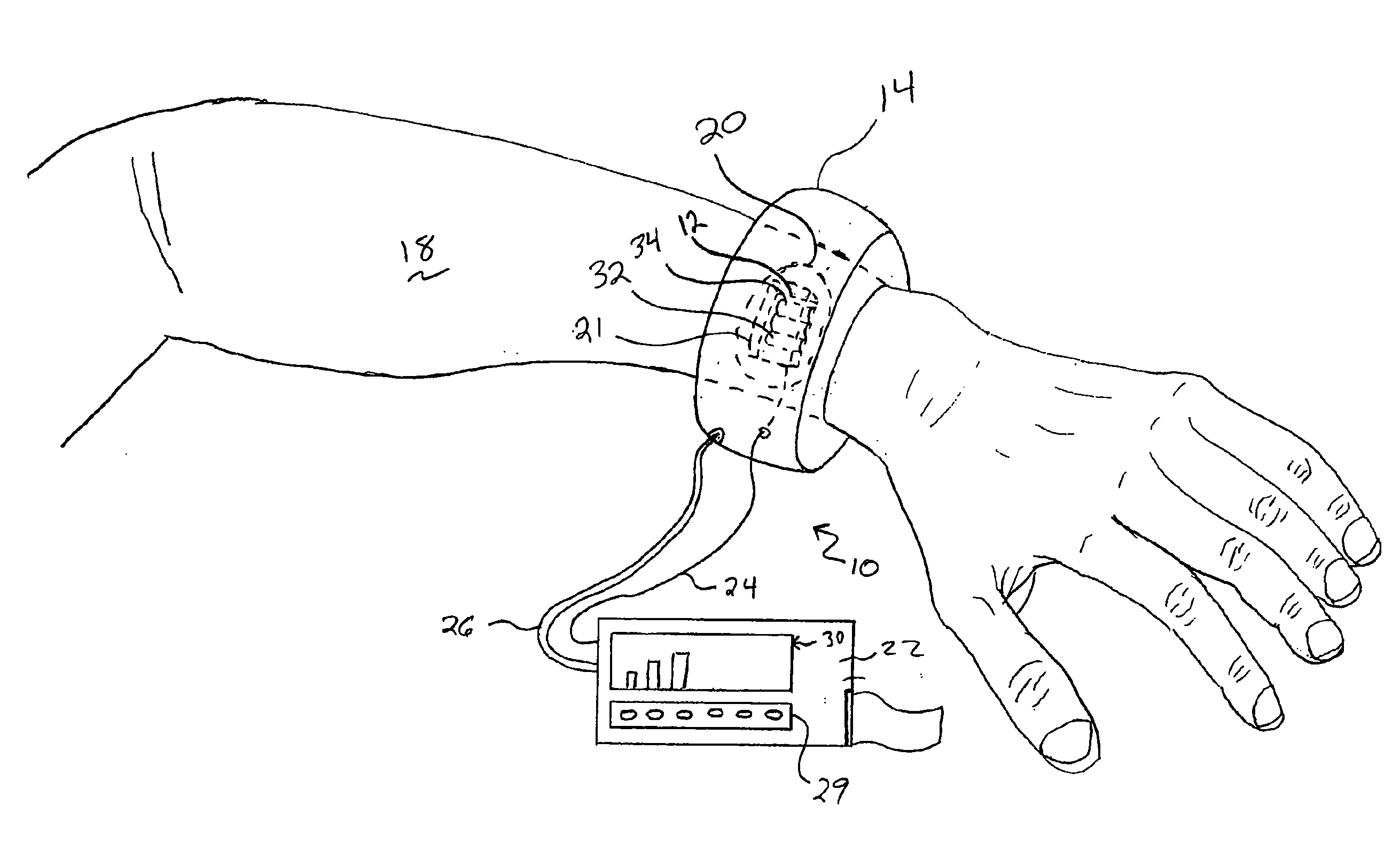 System for Automated Measurement of Skin Perfusion Pressure