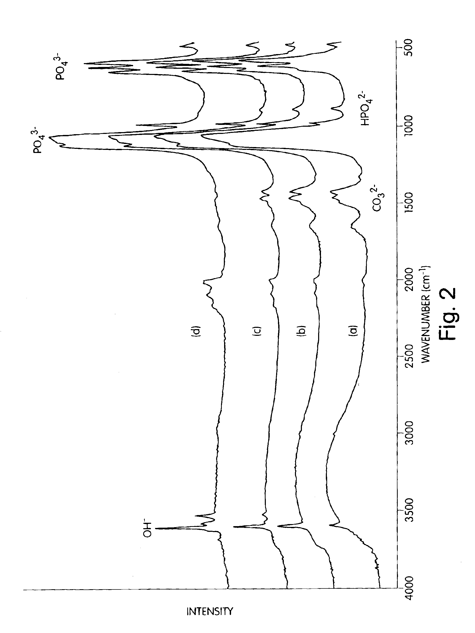 Nanocrystalline apatites and composites, prostheses incorporating them, and method for their production